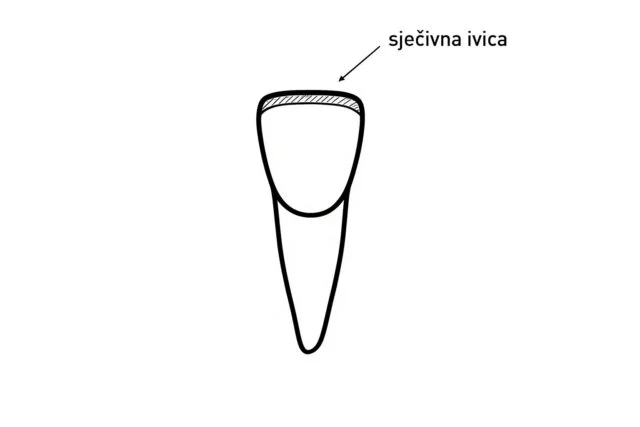 sjeciva ivica vogdent