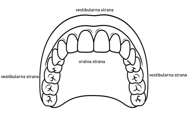 vestibualrna oralna strana vogdent