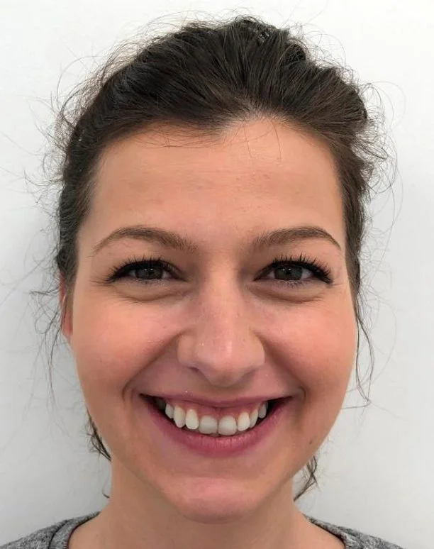 Ortodoncija Vogdent Sarajevo — prije terapije (Portret), Sabina R.